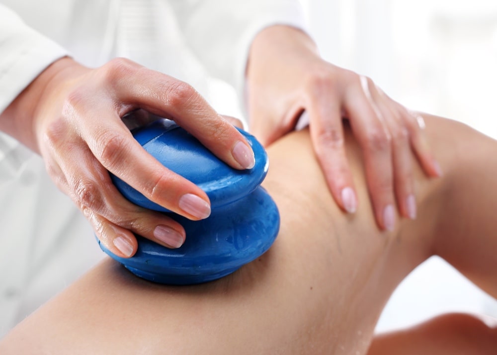 A person receiving cupping therapy on their leg